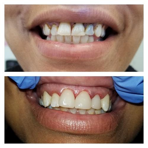 client teeth before and after photo